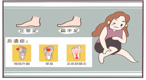 兒童康復科 | 關注扁平足，要從娃娃抓起